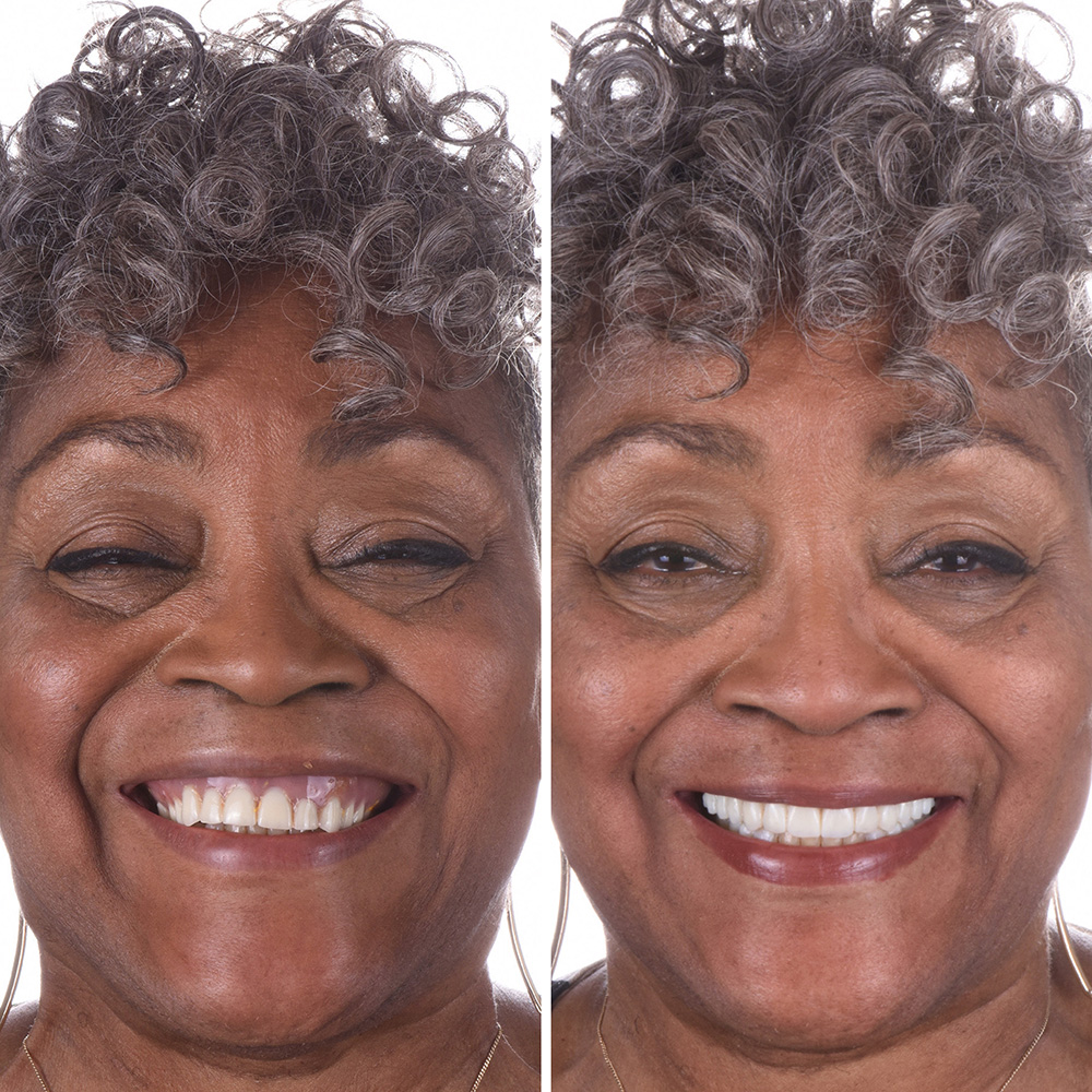 Hydra slider images 3