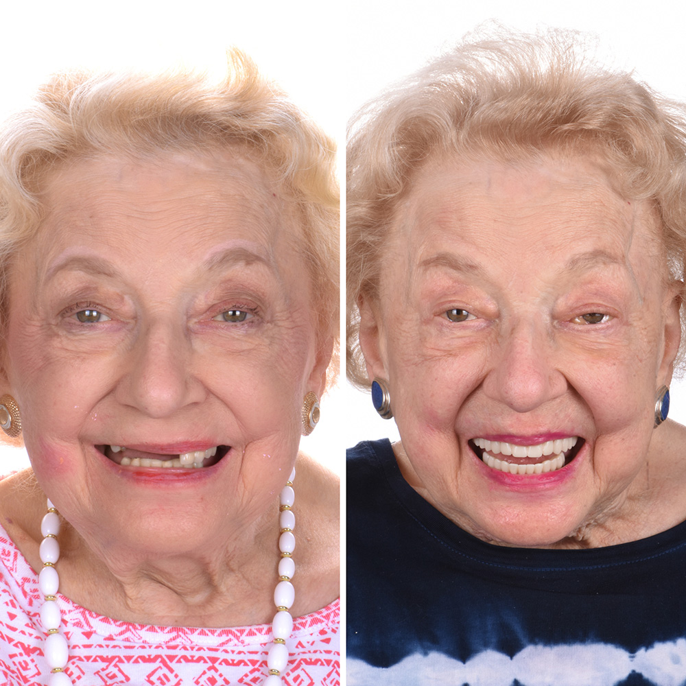 Hydra slider images 4