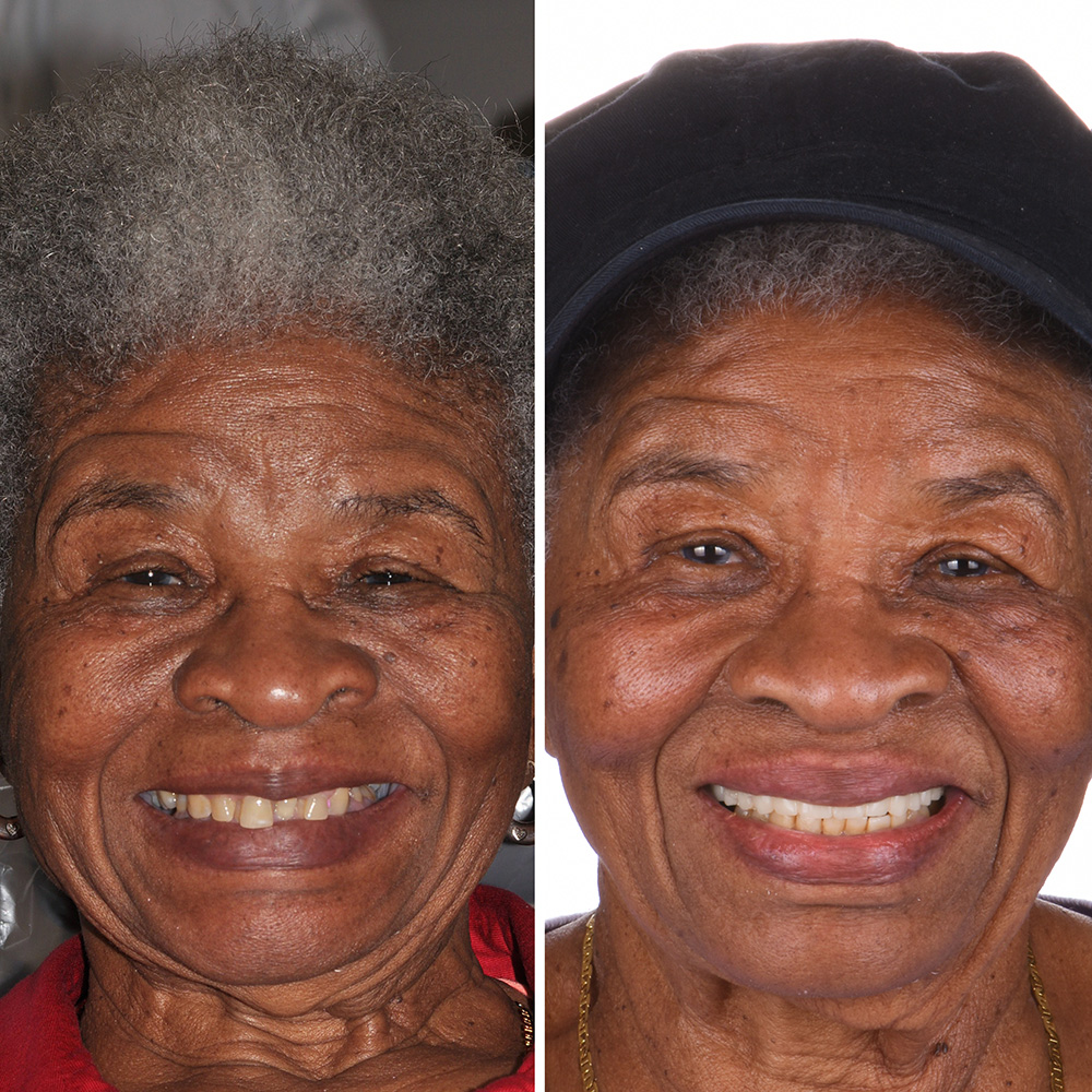 Hydra slider images 5