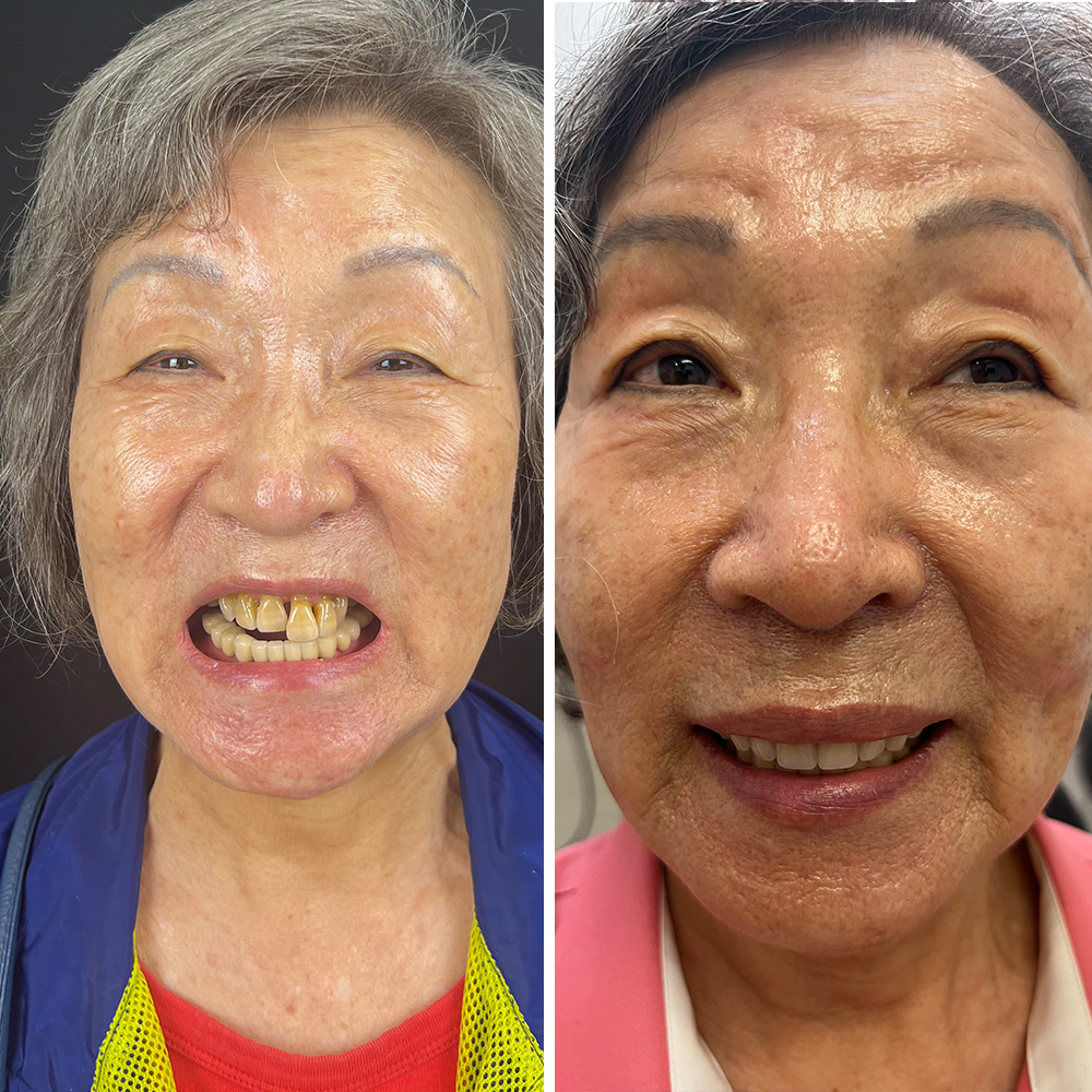 Hydra slider images 6