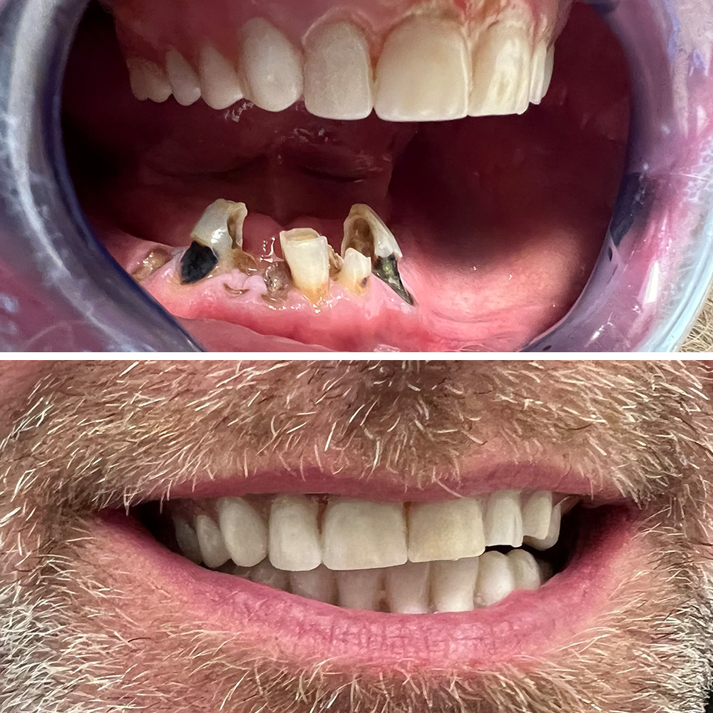 Hydra slider images 7