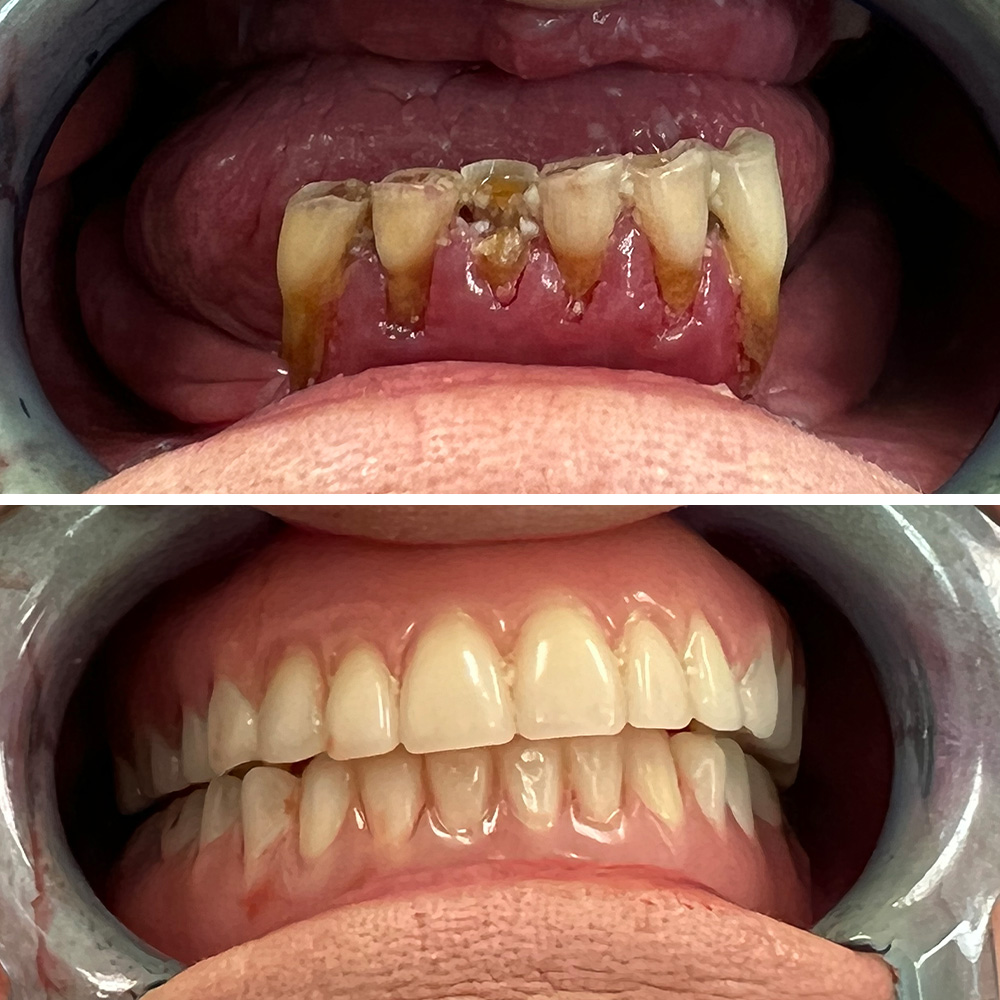 Hydra slider images 8