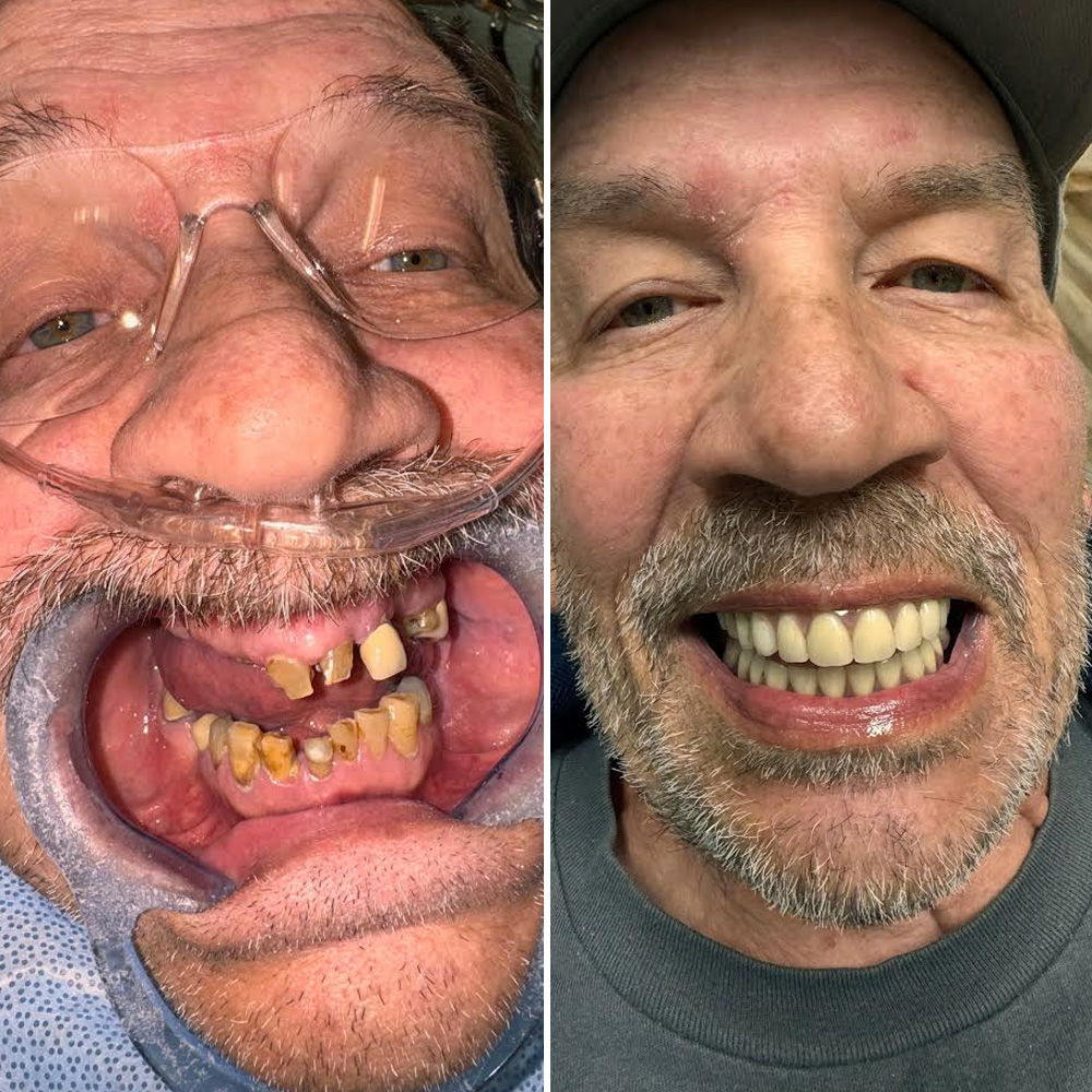 Hydra slider images 2